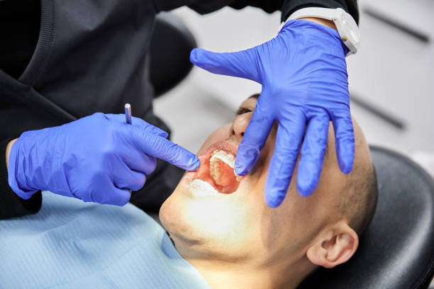 Best Emergency Denture Repair in Odell, OR